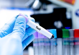 Da bi suzili krug mogućih uzroka visokog ili niskog MCHC, lekari mogu da ga uporede sa rezultatima drugih analiza krvi 