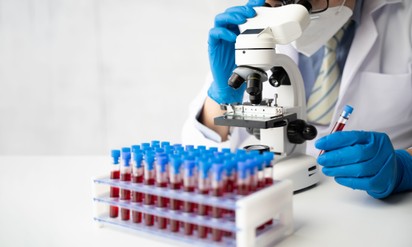 Egy új vérvizsgálat segíthet azonosítani, hogy milyen stádiumban van az Alzheimer-kór