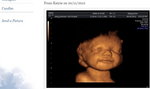 To uśmiech dziecka na zdjęciu USG. Uratował je przed aborcją!