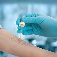 Hogyan értelmezzem az allergiavizsgálatom eredményét? Az orvos válaszol