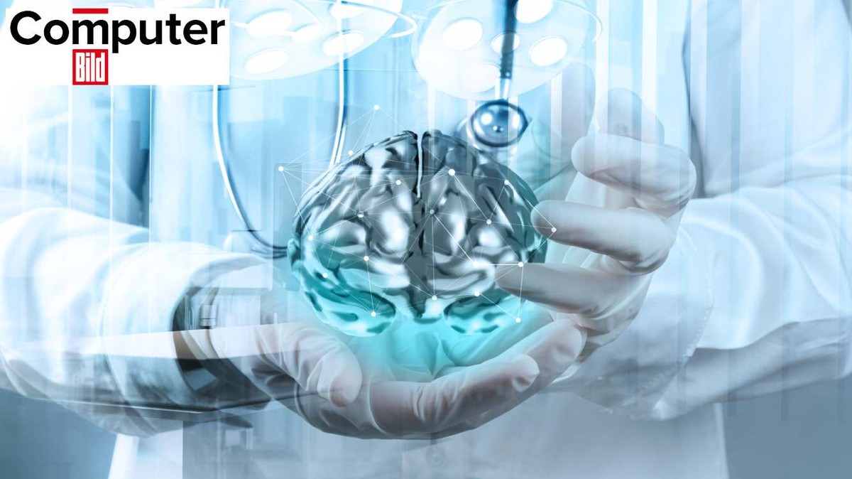 Nagy áttörés: a mesterséges intelligencia segíthet jóval hamarabb felismerni az Alzheimer-kór jeleit