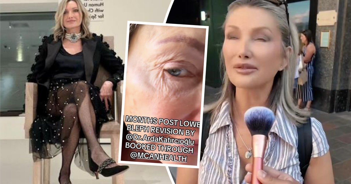 TikTokerka poleciała na operacje plastyczne do Turcji. "Rzeźnicy! Wyglądam gorzej niż przed operacją"