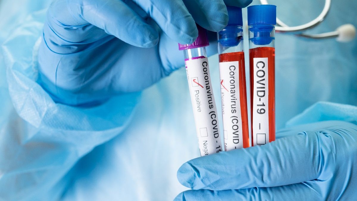 Valul de COVID-19 aduce simptome digestive și complicații de sezon. Atenție la capcana testelor ieftine comandate online!
