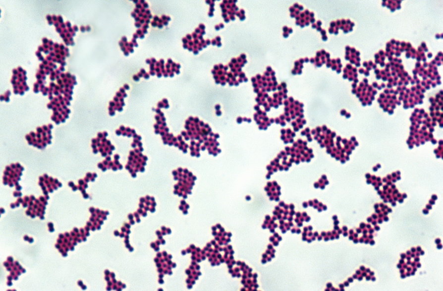 Gronkowiec złocisty - Staphylococcus aureus
