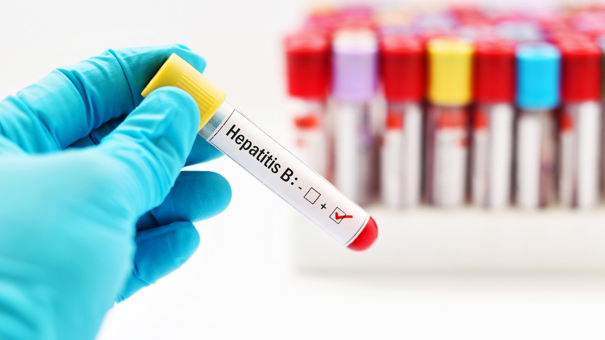 Inaczej mówiąc – antygen HBs, białko S – jest to białko powierzchniowe występujące w surowicy krwi podczas ostrego bądź przewlekłego stadium zakażenia zapaleniem wątroby typu B (czyli żółtaczką wszczepienną). Obecność antygenu HBsAg świadczy o byciu zarażonym wirusem HBV odpowiedzialnym za wirusowe zapalenie wątroby.