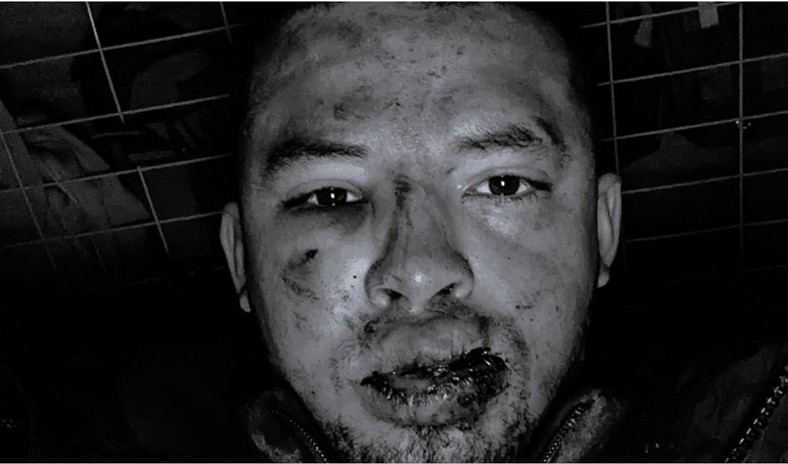 Kamilo Melo na nagraniu wyglądał na pobitego.