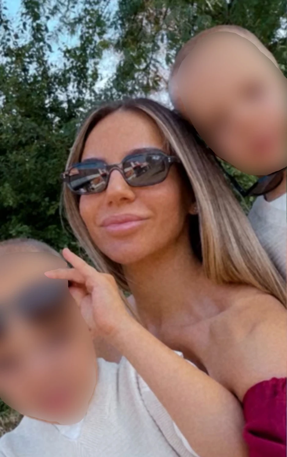 Ivana pokazala blizance