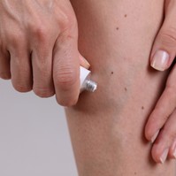 Rossz hír a visszérkrémekről: csak ezeken a problémákon segíthetnek