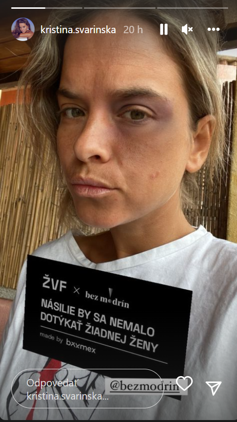 Svarinská zverejnila dobité fotky.