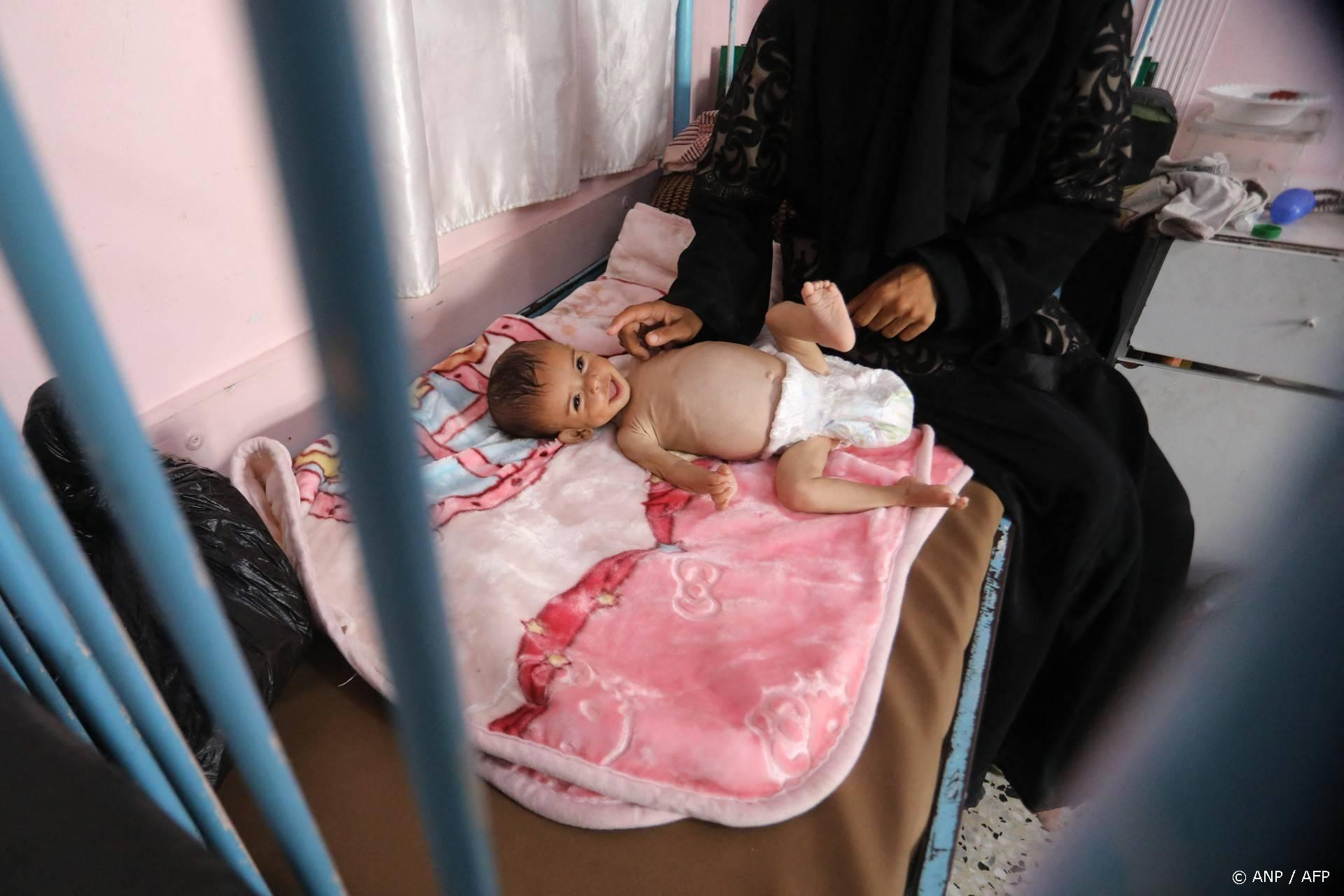 Gaza: Een op vijf kinderen ondervoed, UNRWA waarschuwt