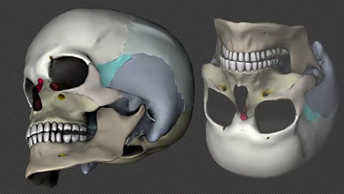 Irlandczycy wynaleźli nową metodę druku 3D chrząstek do implantów