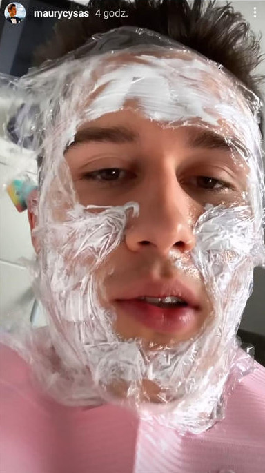 Maurycy z "Hotelu Paradise" przeszedł operację plastyczną nosa
