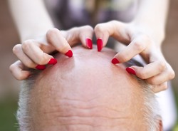 Panowie, problem z głowy. Będzie lek na łysinę