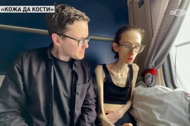 Anastasija ima samo 29 KILOGRAMA NA 176cm VISINE: "Bila sam jednom ZALJUBLJENA, ali nisam smela da priznam, ionako muškarci osećaju GAĐENJE kad me vide"