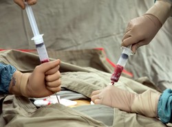 Mamy przełom w leczeniu AIDS? Kluczem przeszczep szpiku