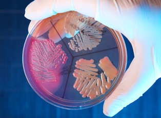 Epidemia E. coli w Wielkiej Brytanii. Pierwsza osoba zmarła