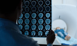 Tomografia głowy – na czym polega to badanie?