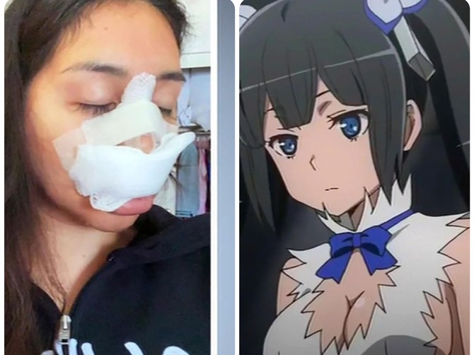 Krišom se operisala da liči na anime junakinju