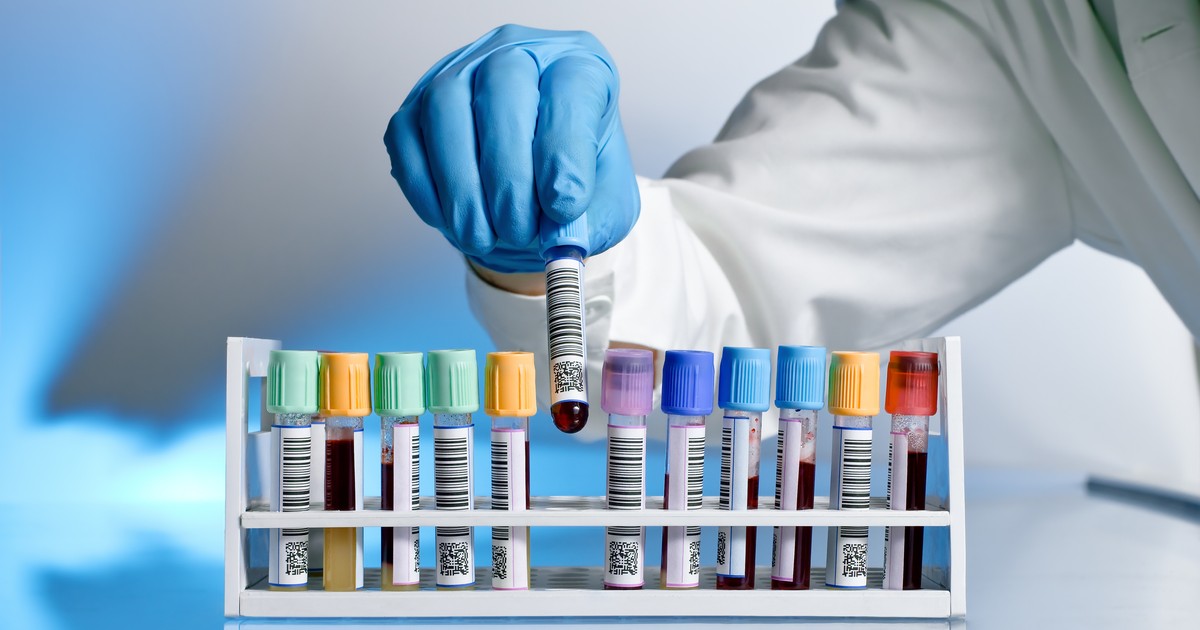 Rewolucyjne odkrycie w walce z chorobą Alzheimera. Zbadano 140 tys. mutacji białek