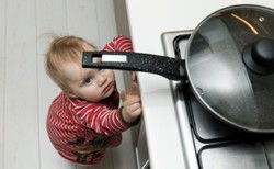 Co zrobić, kiedy dziecko się poparzy?