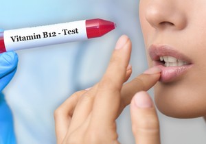 Signali nedostatka vitamina B12 na i u ustima 