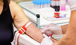 Kiedy wykonać badanie na krzepliwość krwi? Takie są wskazania