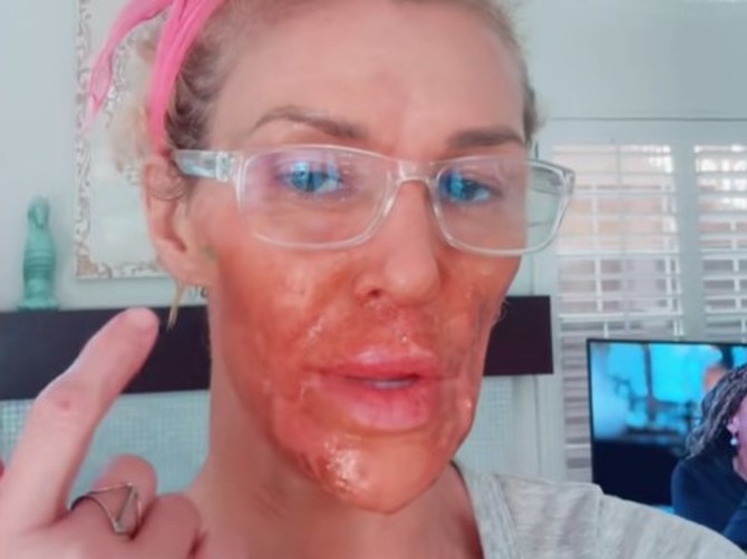 Bila je lepotica sa televizije, a sad joj se lice raspada