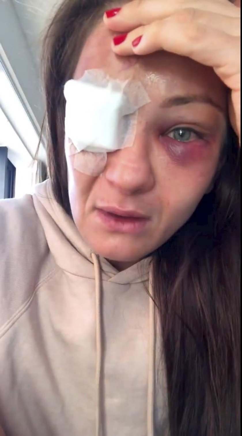 Karolina Kowalkiewicz po walce