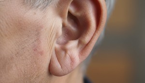 Frankov znak je duboka bora koja se formira na jednoj ili obe ušne resice