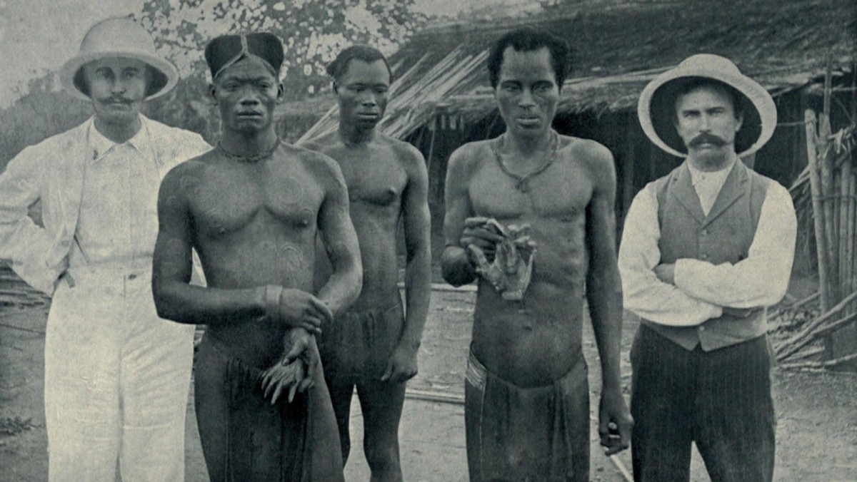 Atrocities of the Rubber Slavery in the Belgian Congo. Natives hold the severed hands of two country