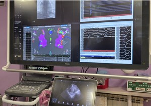 Affera - novi sistem za lečenje aritmija