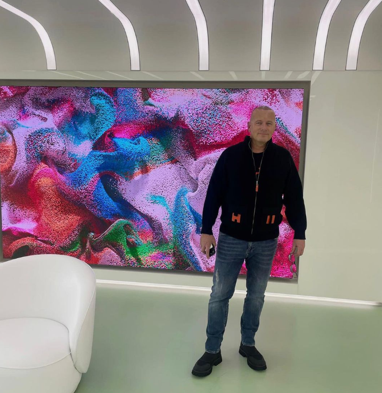 Boris Kollár podstúpil transplantáciu vlasov.