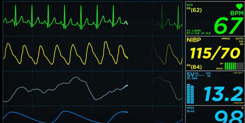 Nikolina Kovačević promenila pol