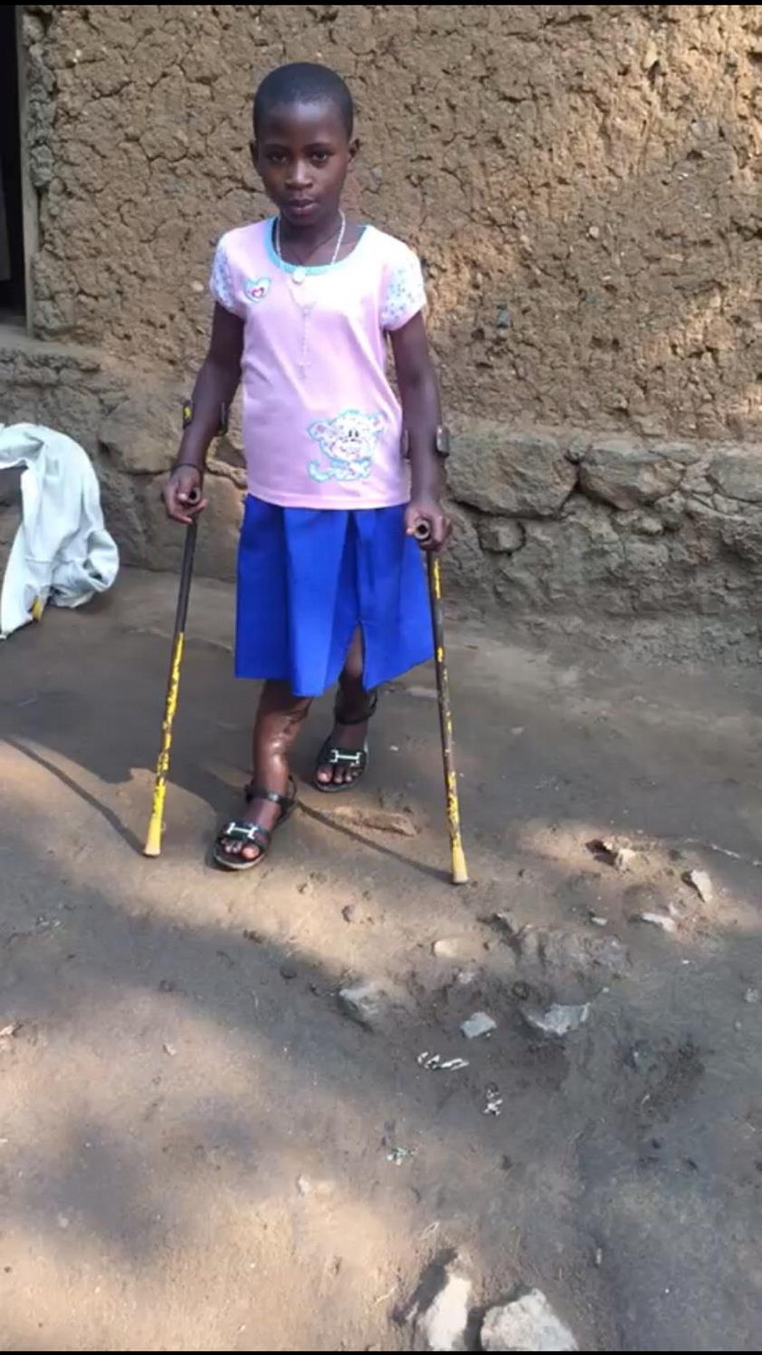 Uratujmy nogę Seraphine z Rwandy!