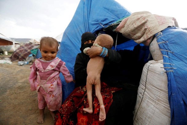 Woman holds her malnourished son next to their tent at a camp for internally displaced people near S