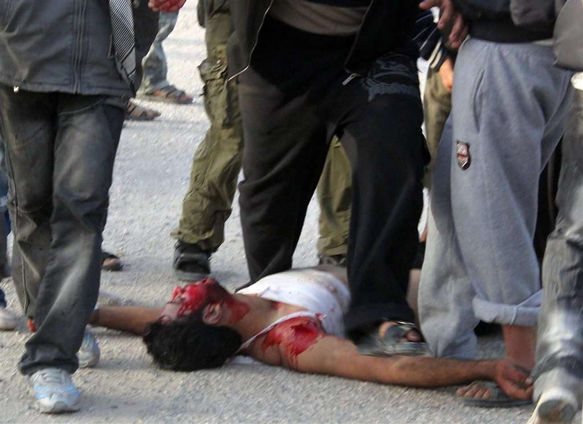 Egipt spływa krwią i walczy! DRASTYCZNE FOTO