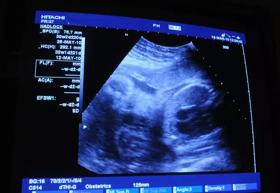 PiS planuje rejestr ciąż? Aktywistki uspokajają: "nie zakładamy najgorszego"