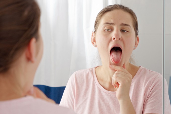 Lepedék a nyelven, dudor a szájban: gombás vagy bakteriális fertőzés jelei?