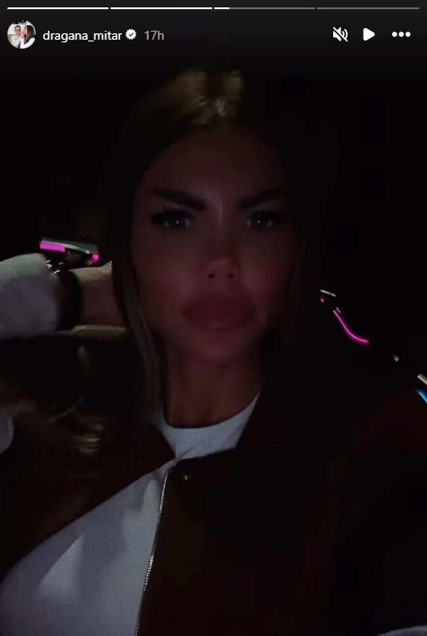 PEVAČICA IMALA AFERU SA OŽENJENIM, PA SE POVUKLA IZ JAVNOSTI: Operisala nos 8 puta, smršala 20 kg, a evo kako Dragana danas izgleda