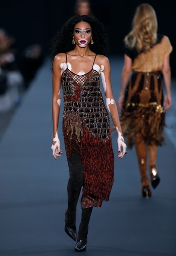 Modelka Winnie Harlow