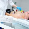 Ekg 