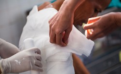 Najgorsze są oparzenia od ognia, powodują w ciele człowieka najwięcej destrukcji