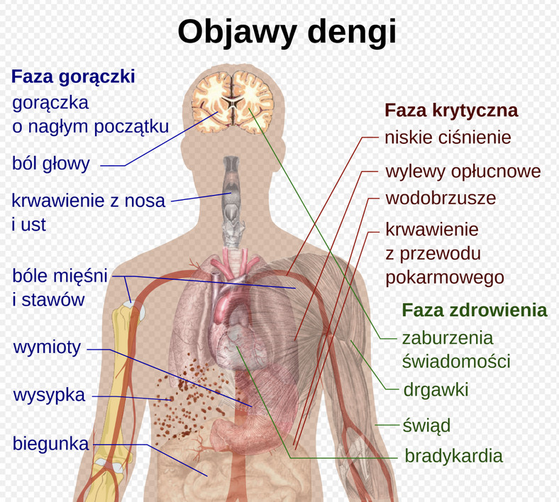 Objawy dengi