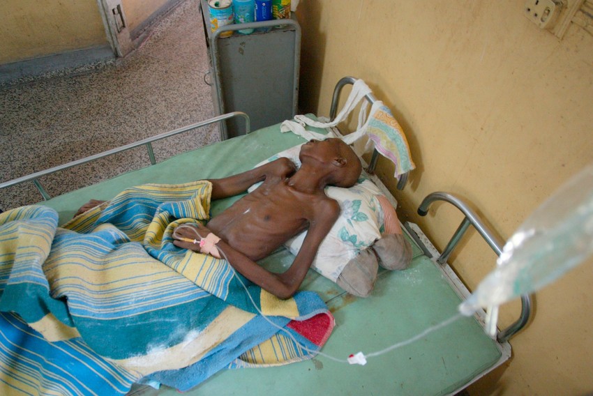 Pacijent oboleo od side