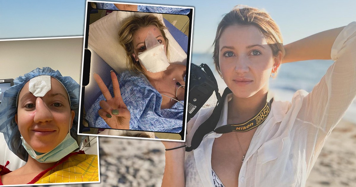 Pies odgryzł jej nos. To, z czego zrobiono nowy, zaskakuje wszystkich