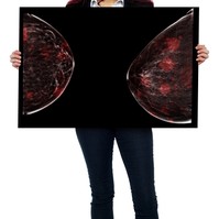 Csomó a mellben: ciszta, lipóma vagy emlőrák okozza? Így derítheti ki