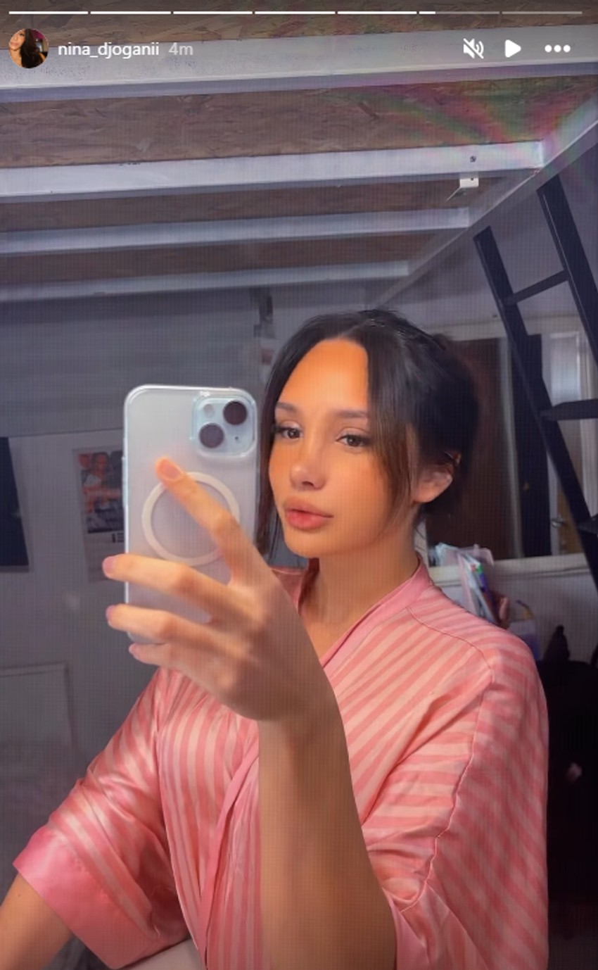 Nina Đogani pokazala novi nos