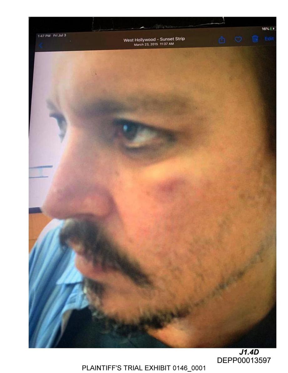 Johnny Depp pokazuje swoją posiniaczoną twarz na zdjęciach przedstawionych jako dowód w procesie o zniesławienie przeciwko byłej żonie Amber Heard