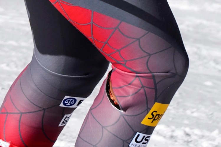 Rana na nodze Bode Millera