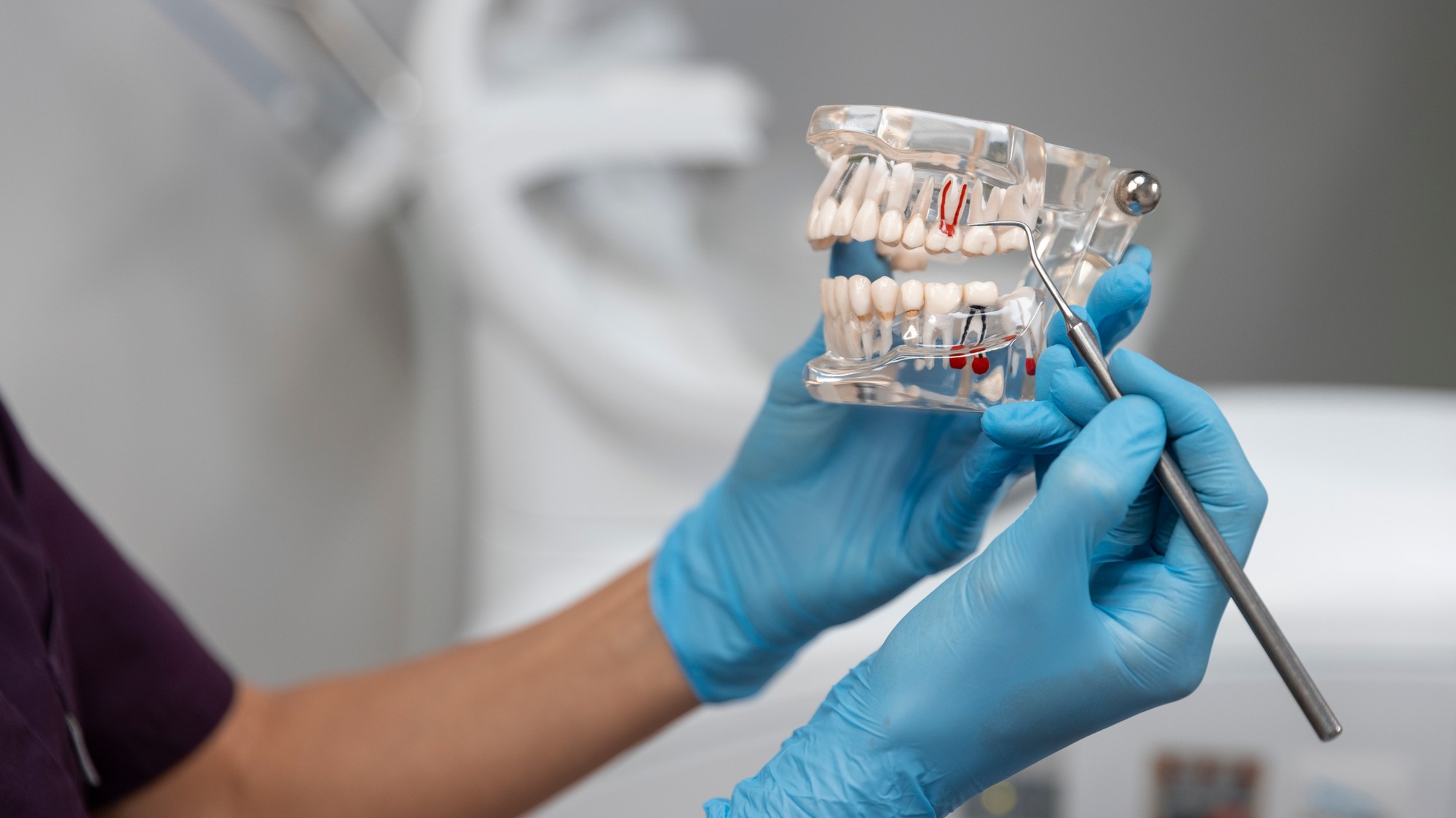 Extrakciu zubu múdrosti musí zubný lekár vždy veľmi dobre zvážiť. 